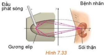 Sơ đồ gương elip trong máy tán sỏi thận